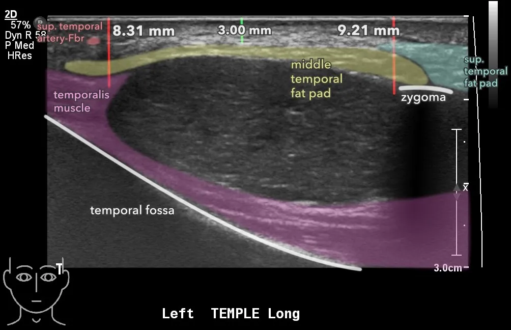 Ultrasounds, MRIs, Surgery, and Malpractice